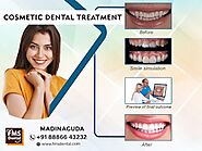 Best cosmetic dental treatment in Madinaguda