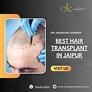 Best Hair Transplant in Jaipur