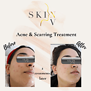 Aesthetic Treatments Blog | Skin NV Clinic London