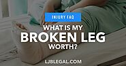 How Much is my Broken Leg Claim Worth? | Loyd J Bourgeois, LLC