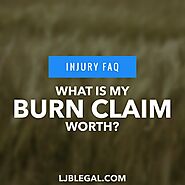 What is a fair settlement for a burn injury? | Loyd J Bourgeois, LLC