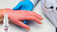 Treating Bacterial Skin Infections 10x More Effectively with Vitastem Ultra - DiseaseFix