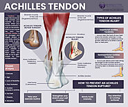 Achilles Tendon