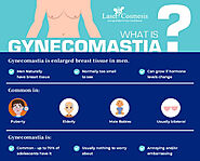 6 Amazing Facts About Gynecomastia