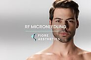 RF Microneedling - Skin Tightening | Fiore Aesthetics