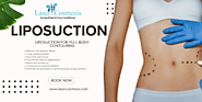 Liposuction For Full Body Contouring