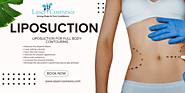 Procedure of Liposuction Surgery - TheOmniBuzz