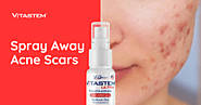 Got Acne Scars? Treat & Heal Them with Vitastem Ultra’s Topical Antibiotic Spray - Designer Women