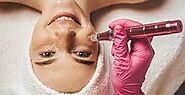 "Dubai's Best-Kept Beauty Secret Revealed: Pigmentation Treatment for Radiant Skin"