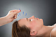 Acupuncture Treatment in London | London Osteopathy Pilates - LONDON OSTEOPATHY AND PILATES