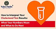 Understanding Your Cholesterol Test Results: Interpreting Numbers and Taking Action