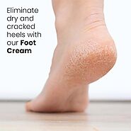 How To Heal Cracked Heels in Two Steps