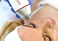 “Dubai’s Best-Kept Beauty Secret: Microneedling for Radiant Skin” – Dynamic clinic