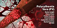 Polycythemia Vera (PV): Market Insights 2023-2033 - Wissen Research