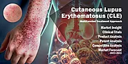 Cutaneous Lupus Erythematosus : Market Insights 2023-2033 - Wissen Research