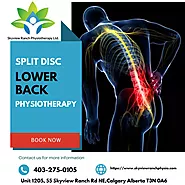 Split Disc Lower Back Physiotherapy Treatment | Skyview Ranch Physiotherapy +1 403-275-0105