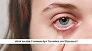 Common Eye Disorders and Diseases: Symptoms, Treatment and Prevention