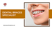 Five signs that indicate a need for dental braces