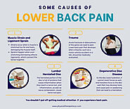 Physical Therapy for Lower Back Pain NYC