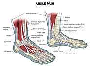 Physical Therapy For Sprained Ankle NYC