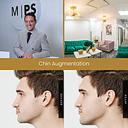 Chin Augmentation NYC