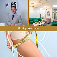 Hip Liposuction NYC