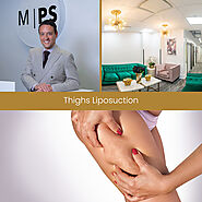 Thighs Liposuction NYC