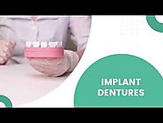 Abbotsford Implant Dentures: Achieve Optimal Comfort and Function