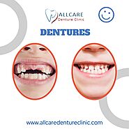 Experience Comfort and Confidence with Dentures in Maple Ridge