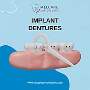 Invest in Long-Term Dental Health with Maple Ridge Implant Dentures