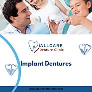 Beyond Traditional Dentures: Implant Solutions in Richmond