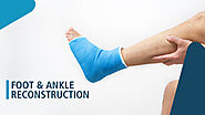 Ankle Surgery: Restoring Mobility and Quality of Life