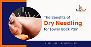 Exploring the Benefits of Dry Needling for Lower Back Pain