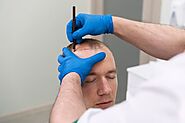 What is the Hair Transplant Cost in Gujarat