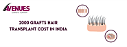 2000 Grafts Hair Transplant Cost in India