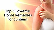 How to Get Rid of Sunburn Redness Overnight [Top 5 Powerful Home Remedies Revealed]