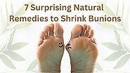 How to Shrink Bunions Naturally | 7 Surprising Remedies to Shrink Bunions