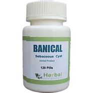 Herbal Supplement for Sebaceous Cyst, Home Remedy for Sebaceous Cyst, Reduce the size of Sebaceous Cyst