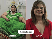 Obesity Patient Before And After Gallery | Obesity Patient Testimonial