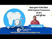 Premier Root Canal Treatment in Mohali