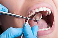 Understanding Root Canal Treatment: Procedure, Importance, and Post-Procedure Care: estheticadental — LiveJournal