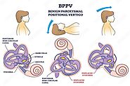 Physiotherapy Interventions For BPPV In Older Adults: Challenges And Considerations