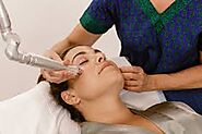 Fractional CO2 Laser Treatment