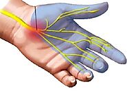 Treatment for Carpal Tunnel Syndrome - Philadelphia Holistic Clinic