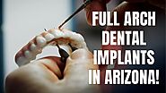 Transform Your Life with Full Arch Dental Implants in Phoenix
