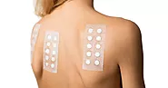 allergy test