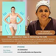 Liposuction Surgery in Hyderabad - Dr. Sandhya Balasubramanyan