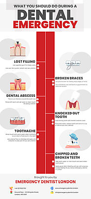 What You Should do during a Dental Emergency