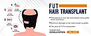 Best Fut Hair Transplant Mumbai, Mira Road | FUT hair transplant cost