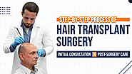 Unveiling the Step-by-Step Process of Hair Transplant Surgery in Mumbai | Cosmed Clinic